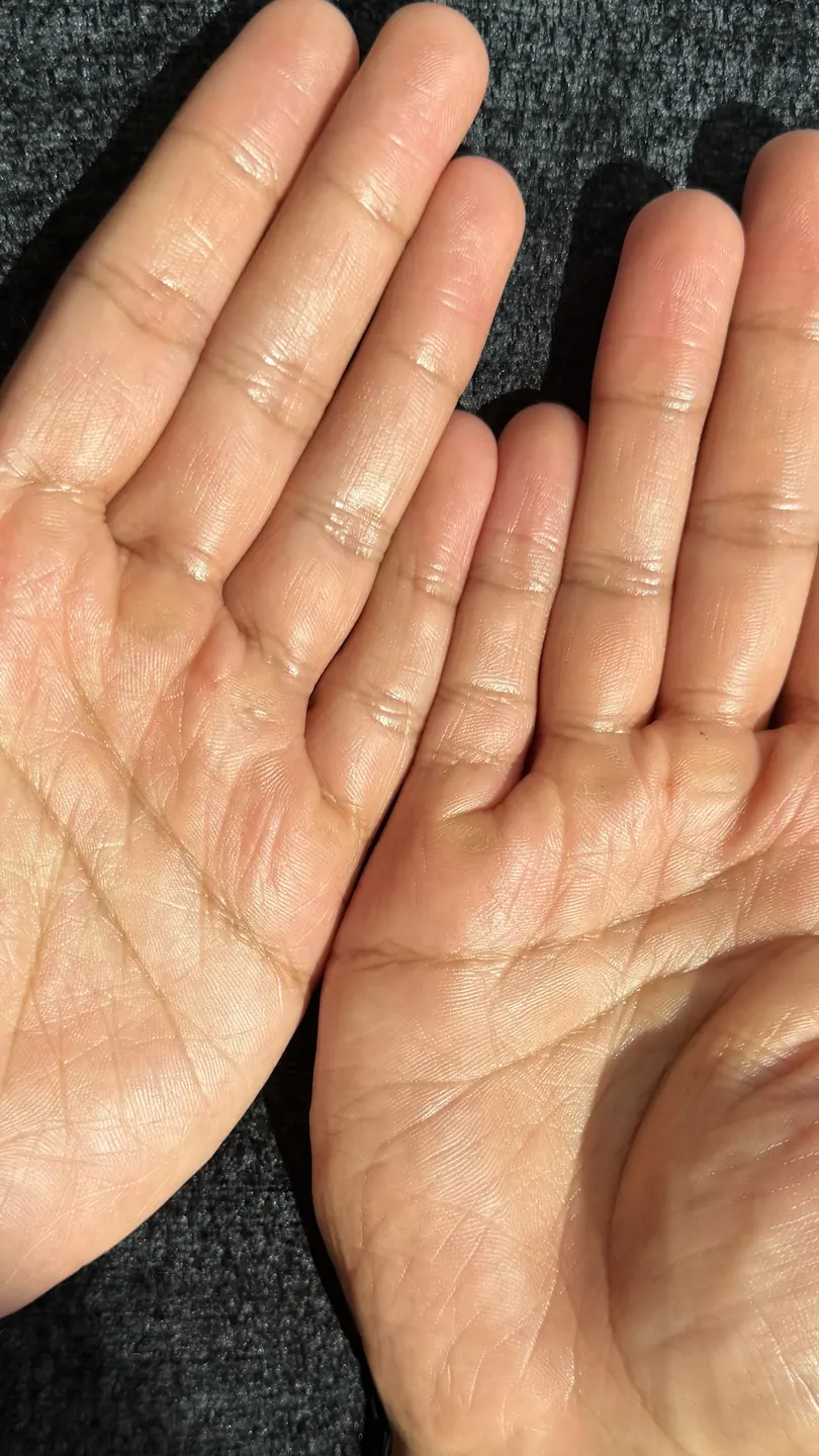 Palms after 1 use
