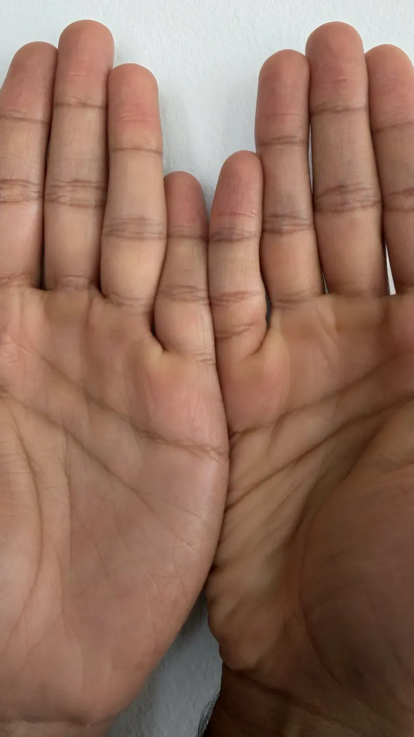 Palms after 4 uses